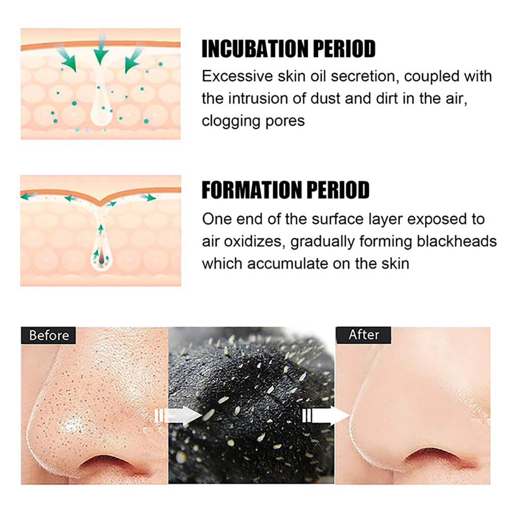 10/20/50/100PCS Nose Blackhead - Skincare Viral Tiktok recension och pris
