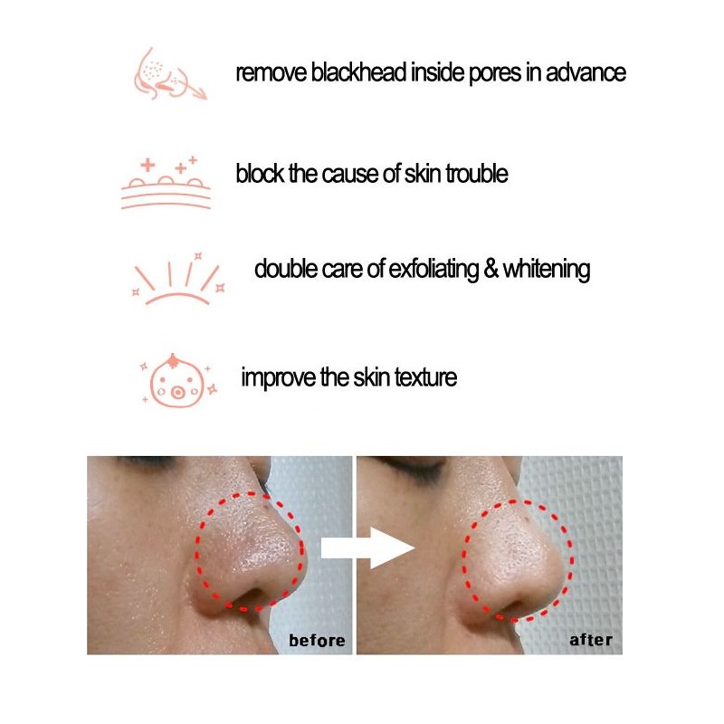 Cosrx BHA Blackhead Power Liqu - Skincare Cosrx recension och pris