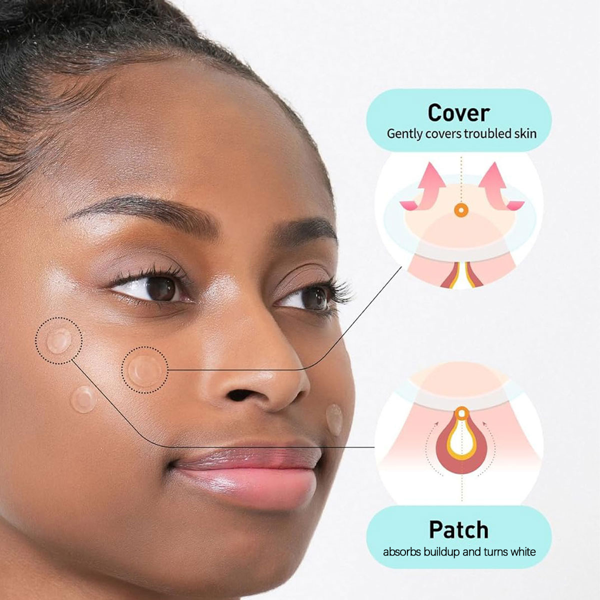 Olive Young Care Plus Spot Cov - Skincare Acne recension och pris