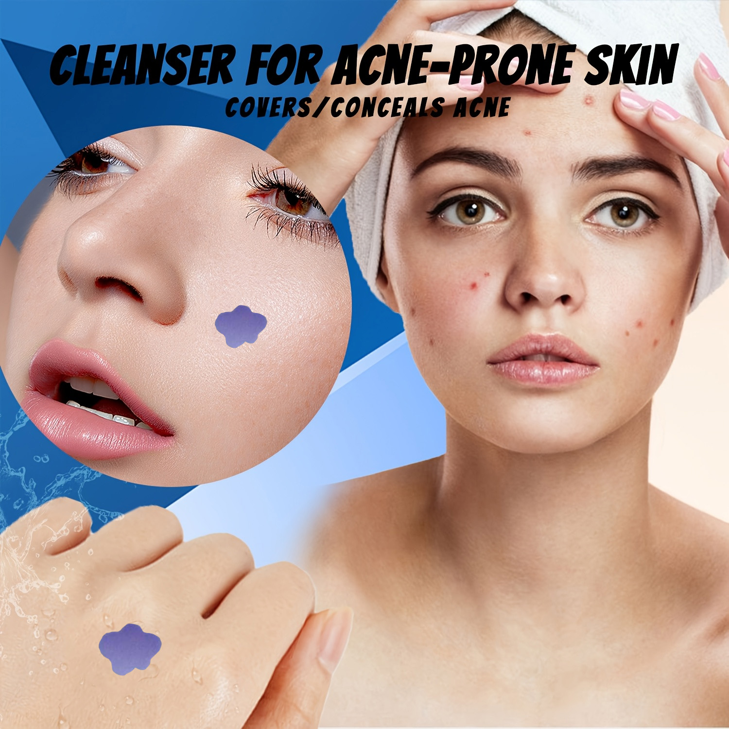 Microneedle Acne Pimple Patch  - Skincare Acne recension och pris