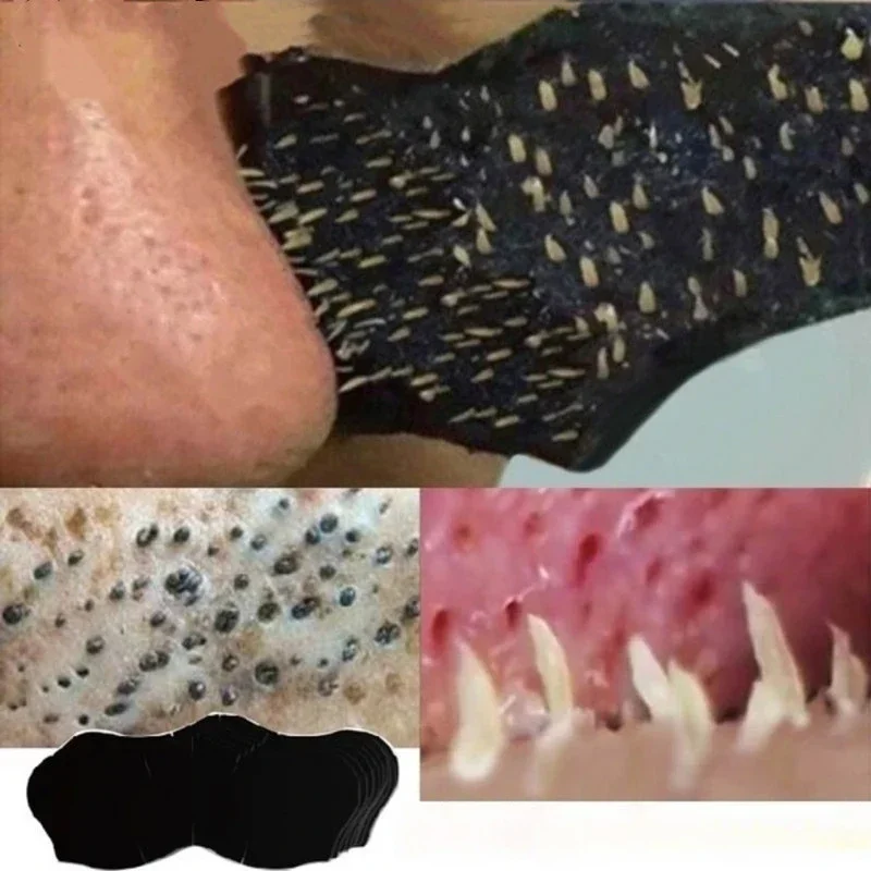 Unisex Blackhead Remove Mask N - Skincare Viral Tiktok recension och pris