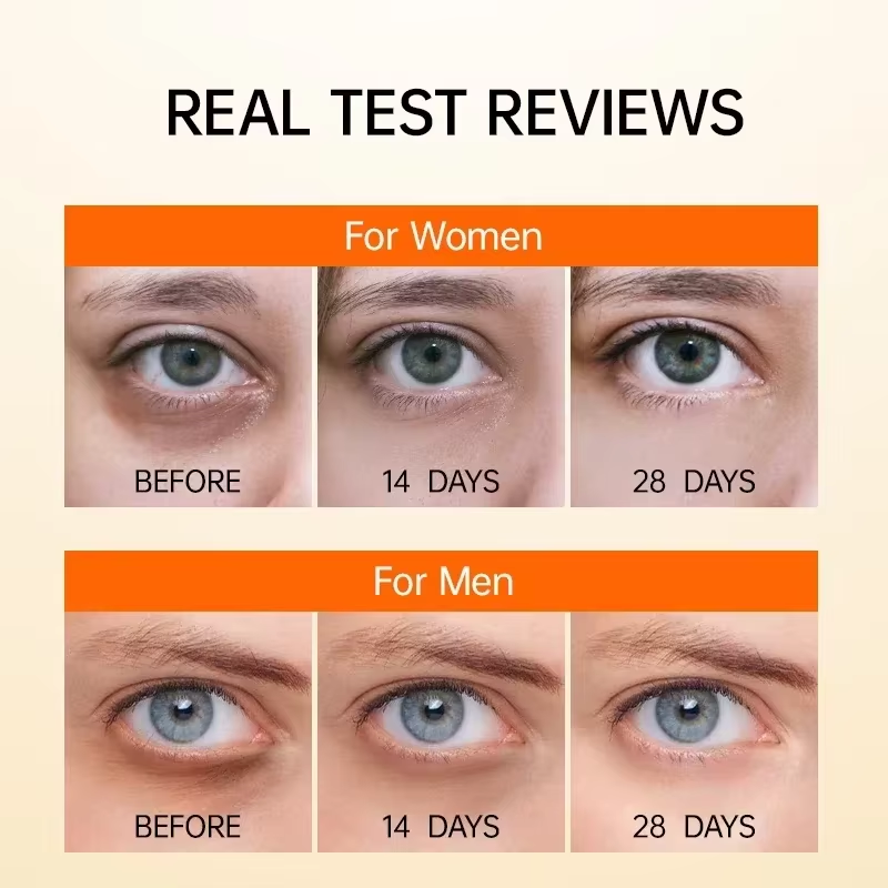 Anti Dark Circle Eye Serum Oil - Caffeine Eye Serum recension och pris