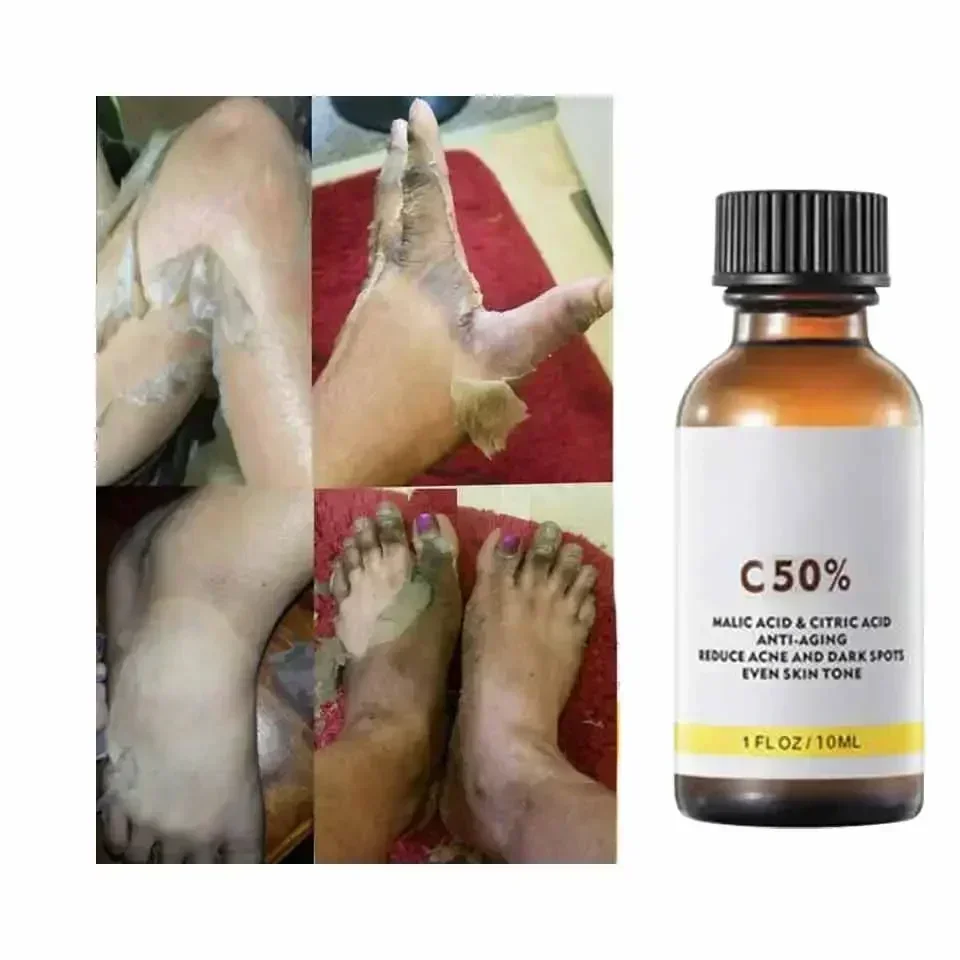 With Malic Acid And Citric Aci - Salicylic Acid Cleanser recension och pris