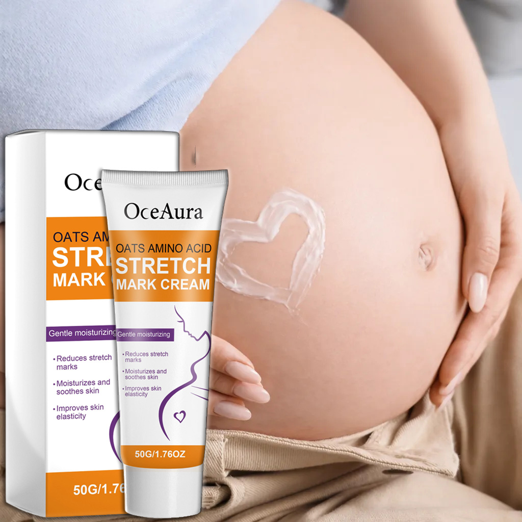 Stretch Marks Body Cream Light - Skincare Oat recension och pris